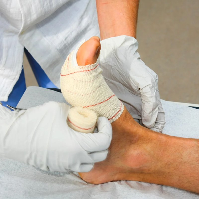 curativo na perna Camila Peñaloza Espina